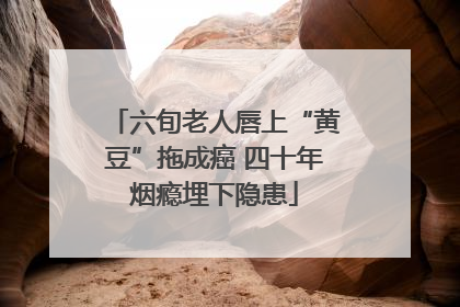 六旬老人唇上“黄豆”拖成癌 四十年烟瘾埋下隐患